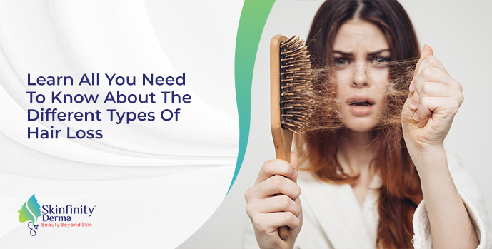 Know About The Different Types Of Hair Loss Skinfinity Hair Clinic