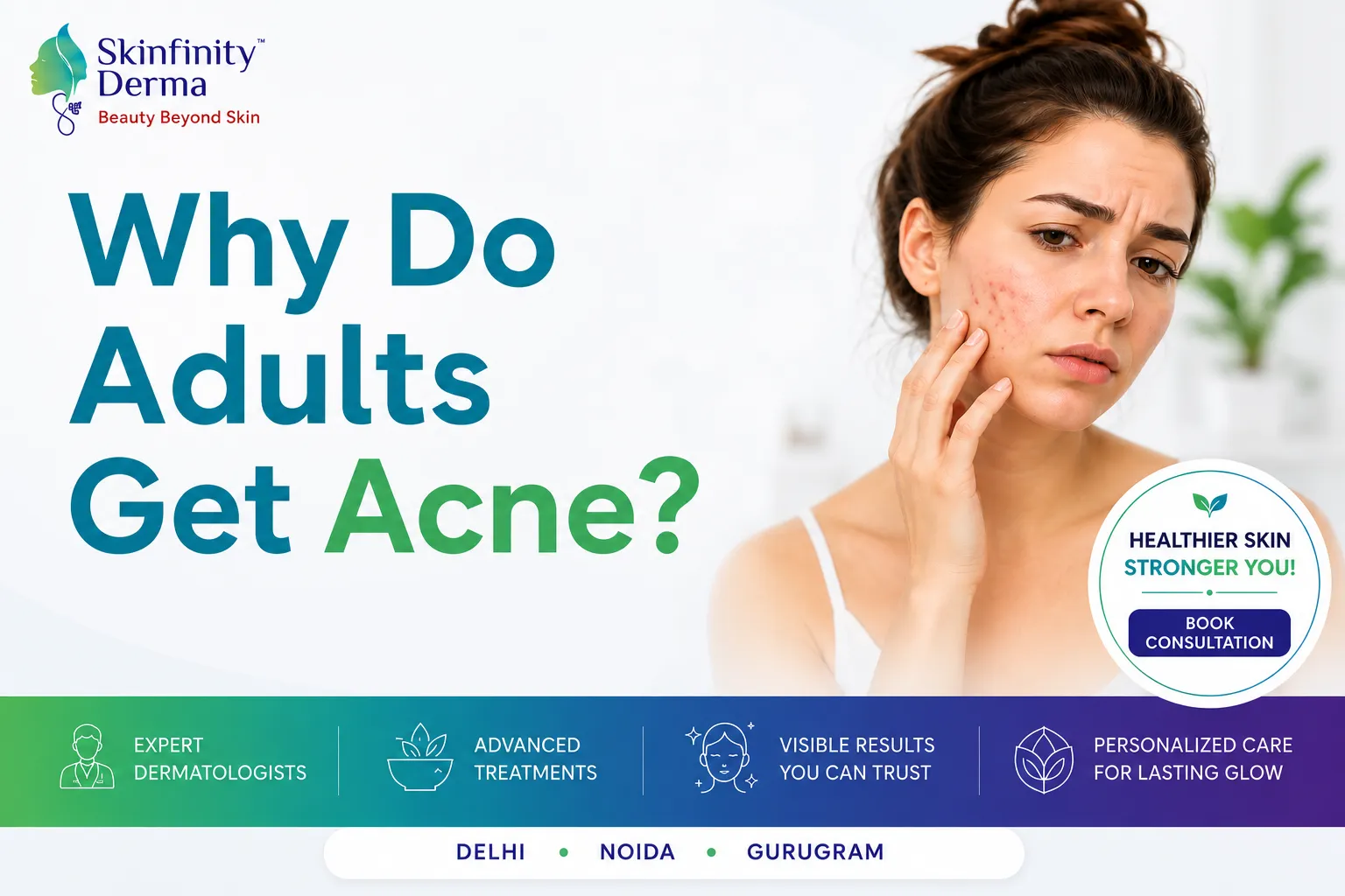 Why Do Adults Get Acne Causes