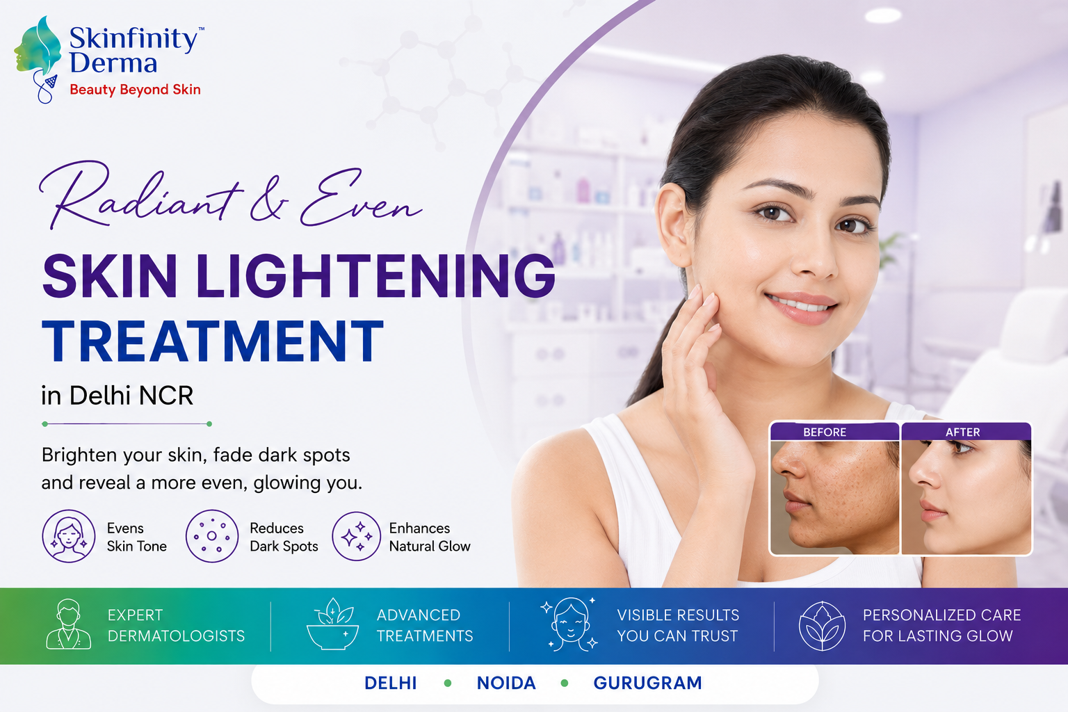 Skin Lightening Treatment