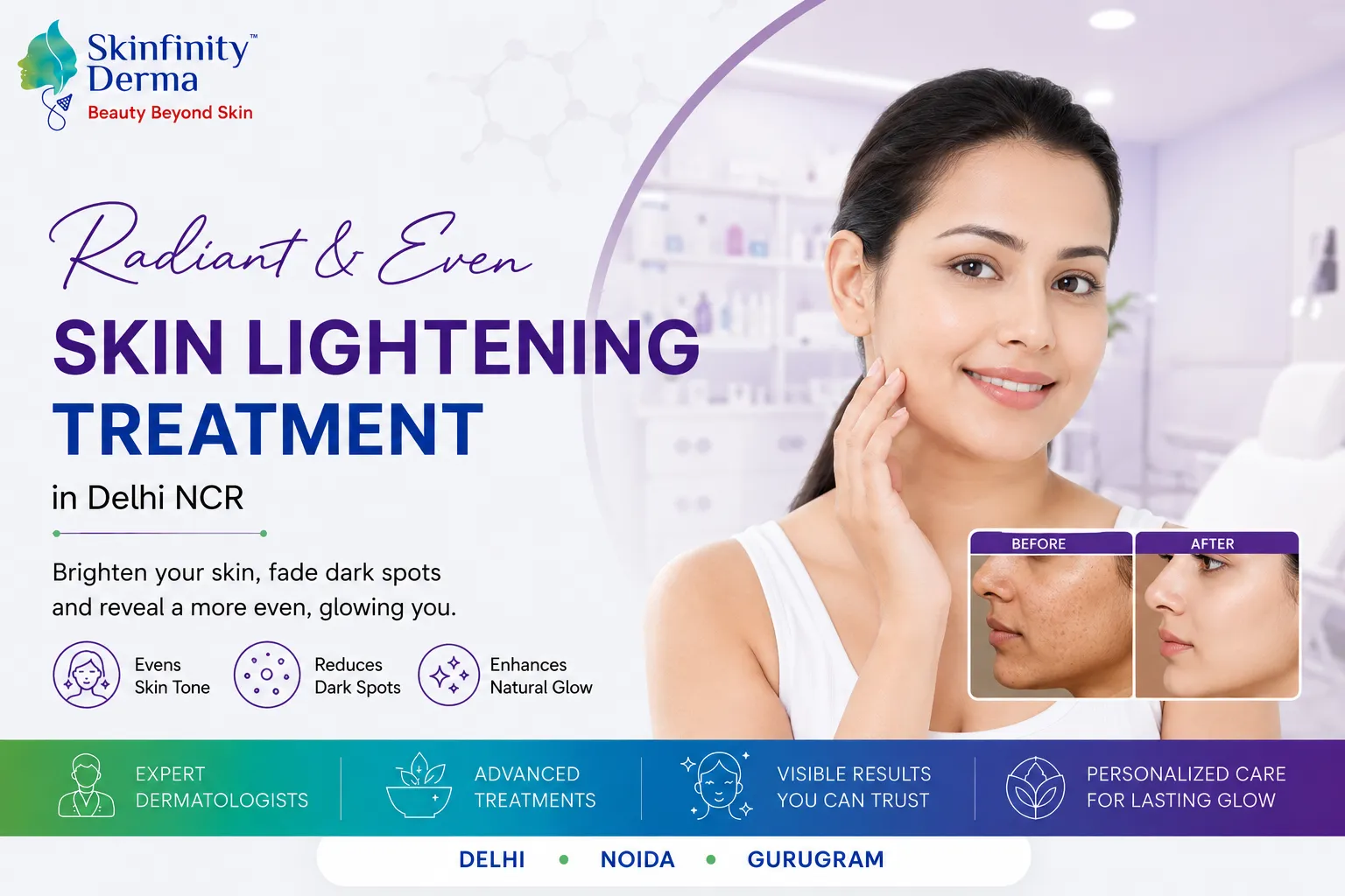 Skin Lightening Treatment