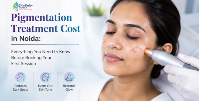 Pigmentation Treatment Cost in Noida