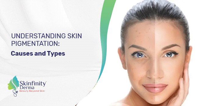 Skin Pigmentation