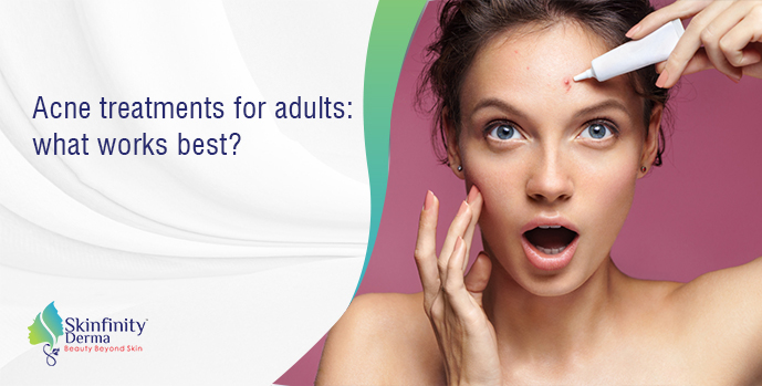 acne treatments