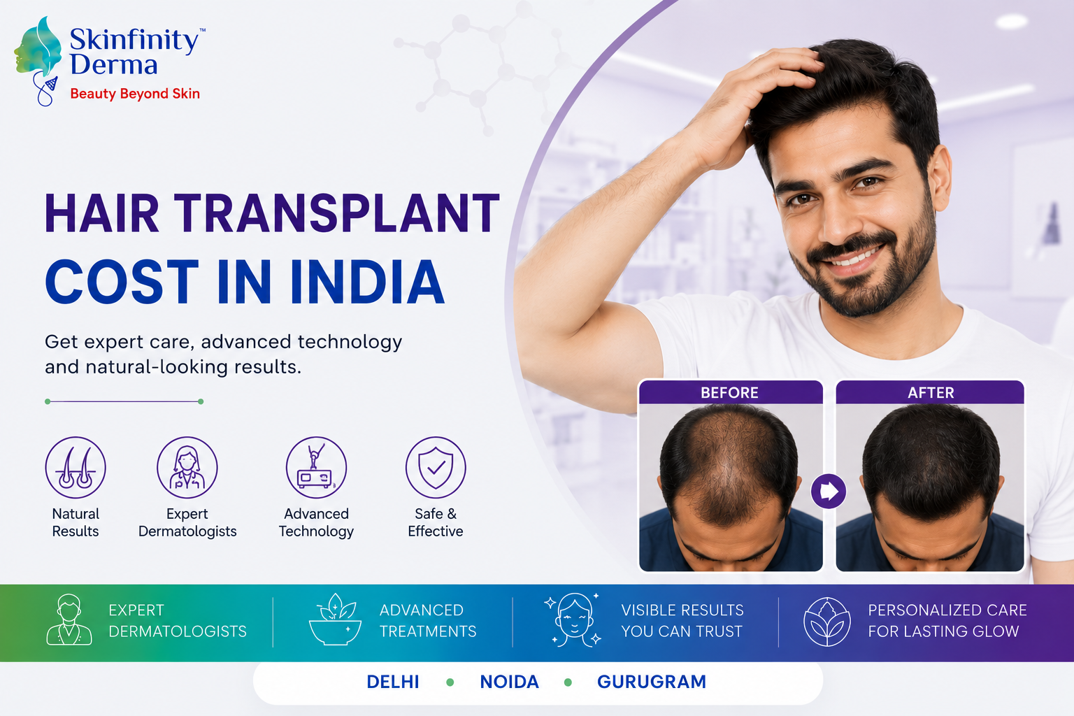 cost of hair transplantation surgery in India
