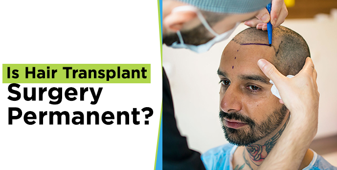 Hair Transplant Surgery 