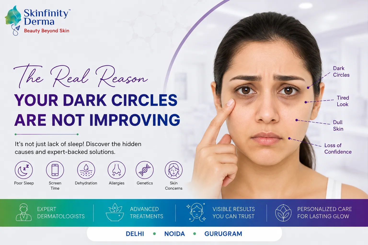 Dark Circles Are Not Improving