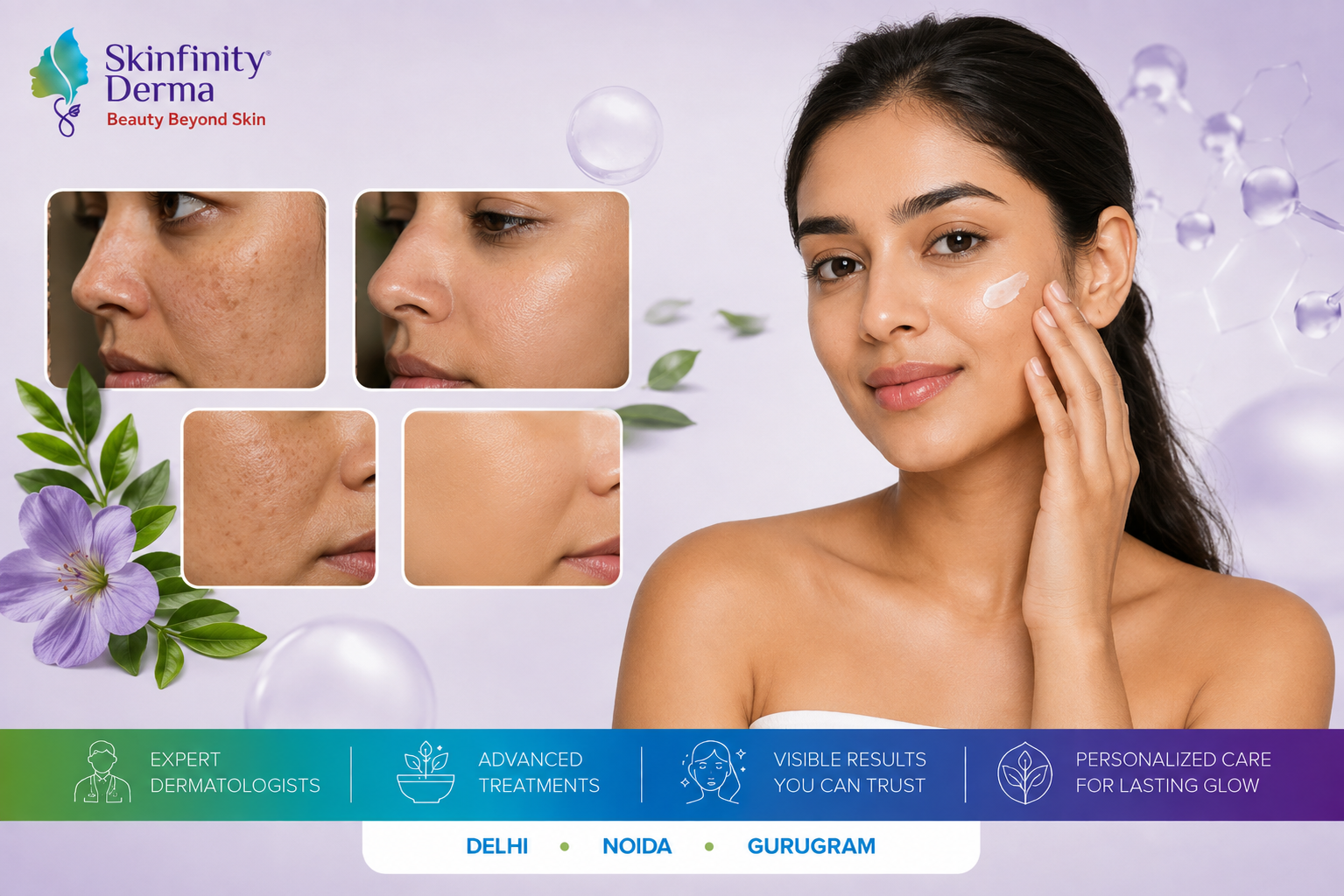 pigmentation treatment for Indian skin