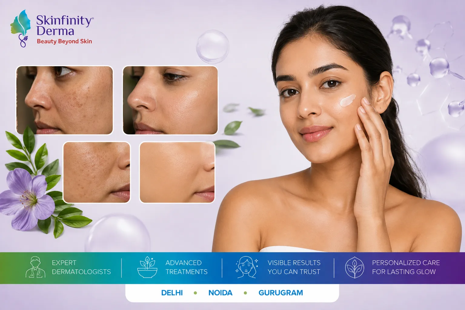 pigmentation treatment for Indian skin