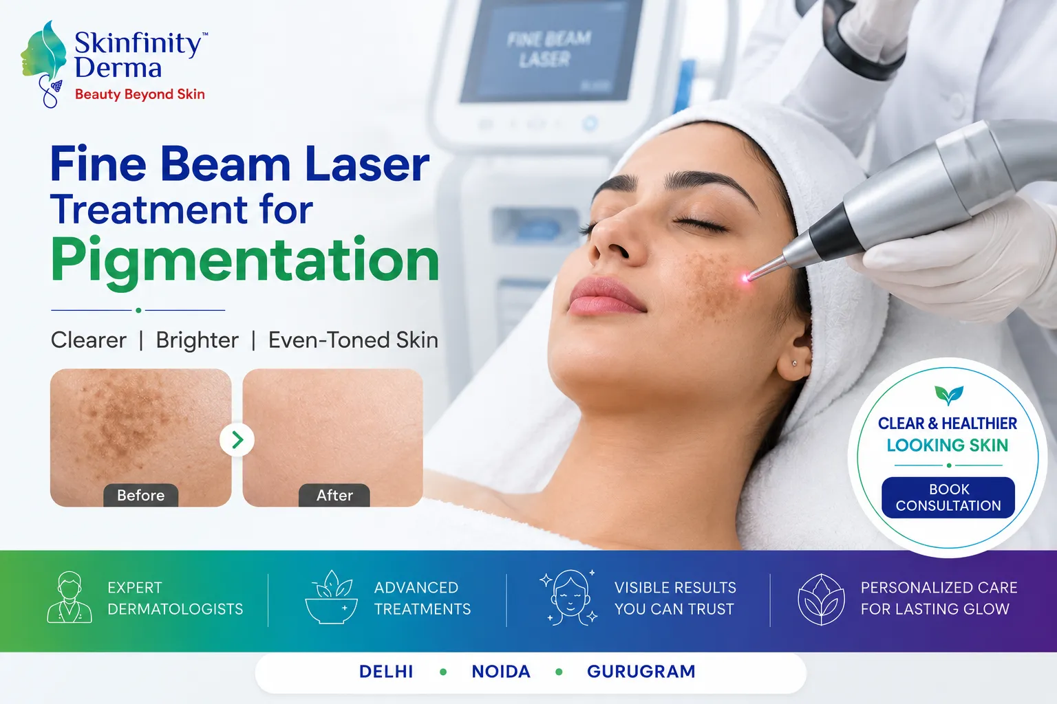 Fine Beam Laser Treatment