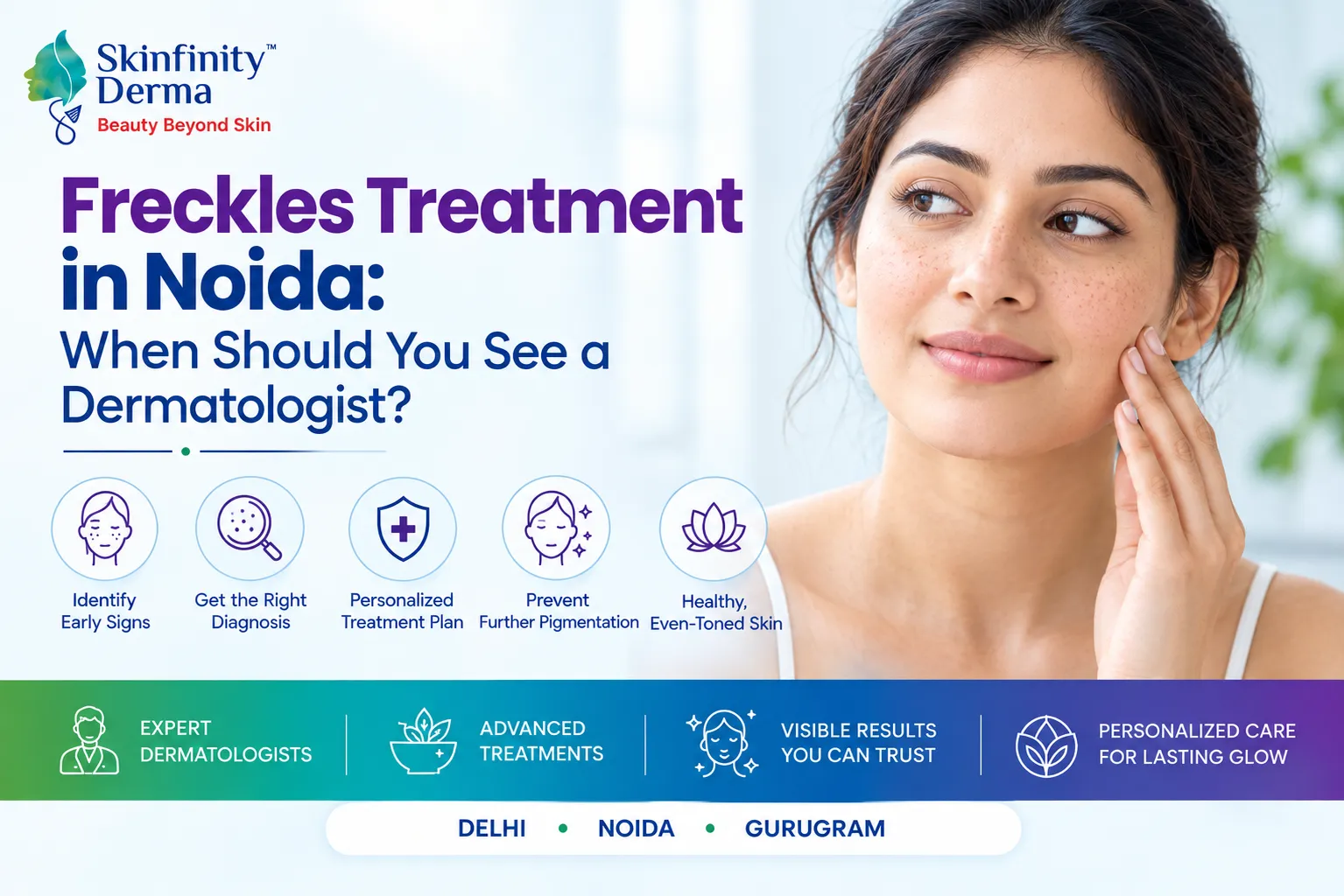 Freckles Treatment in Noida