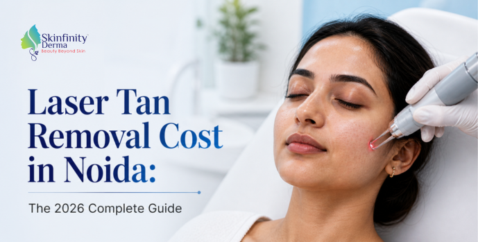 Laser Tan Removal Cost in Noida