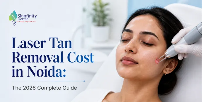 Laser Tan Removal Cost in Noida