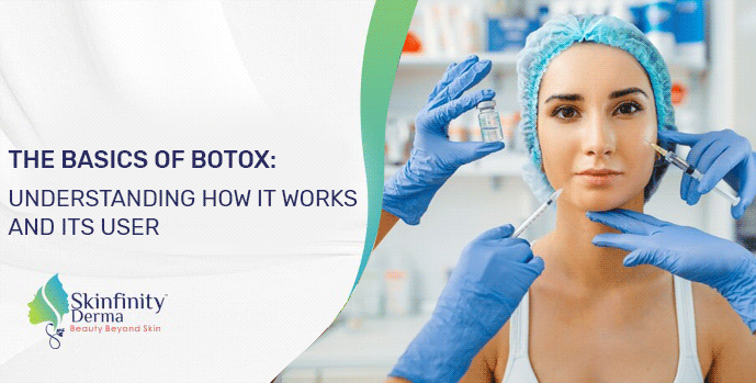 Botox treatment