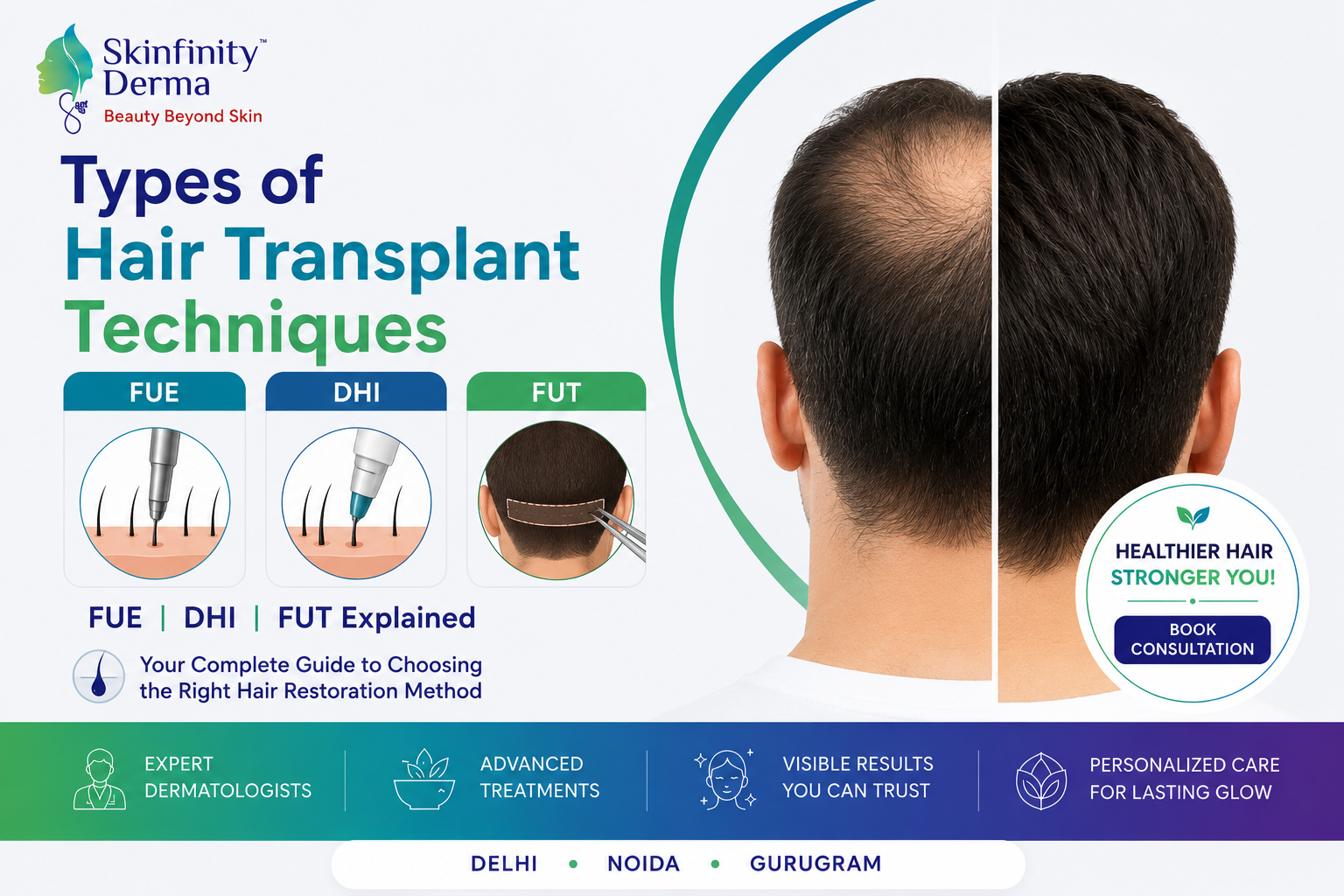 Types of Hair Transplant Techniques