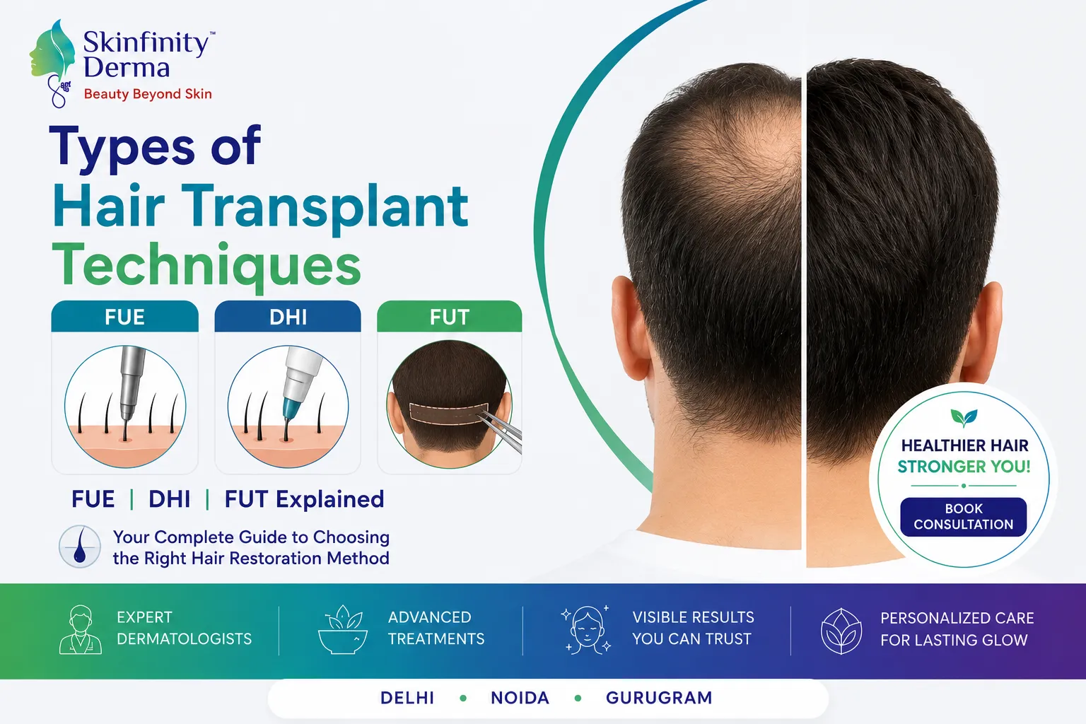 Types of Hair Transplant Techniques