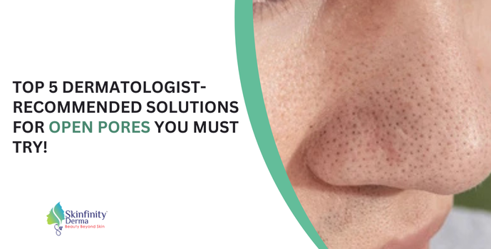 Open Pores 