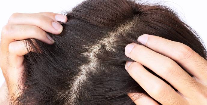 Tips  For Scalp