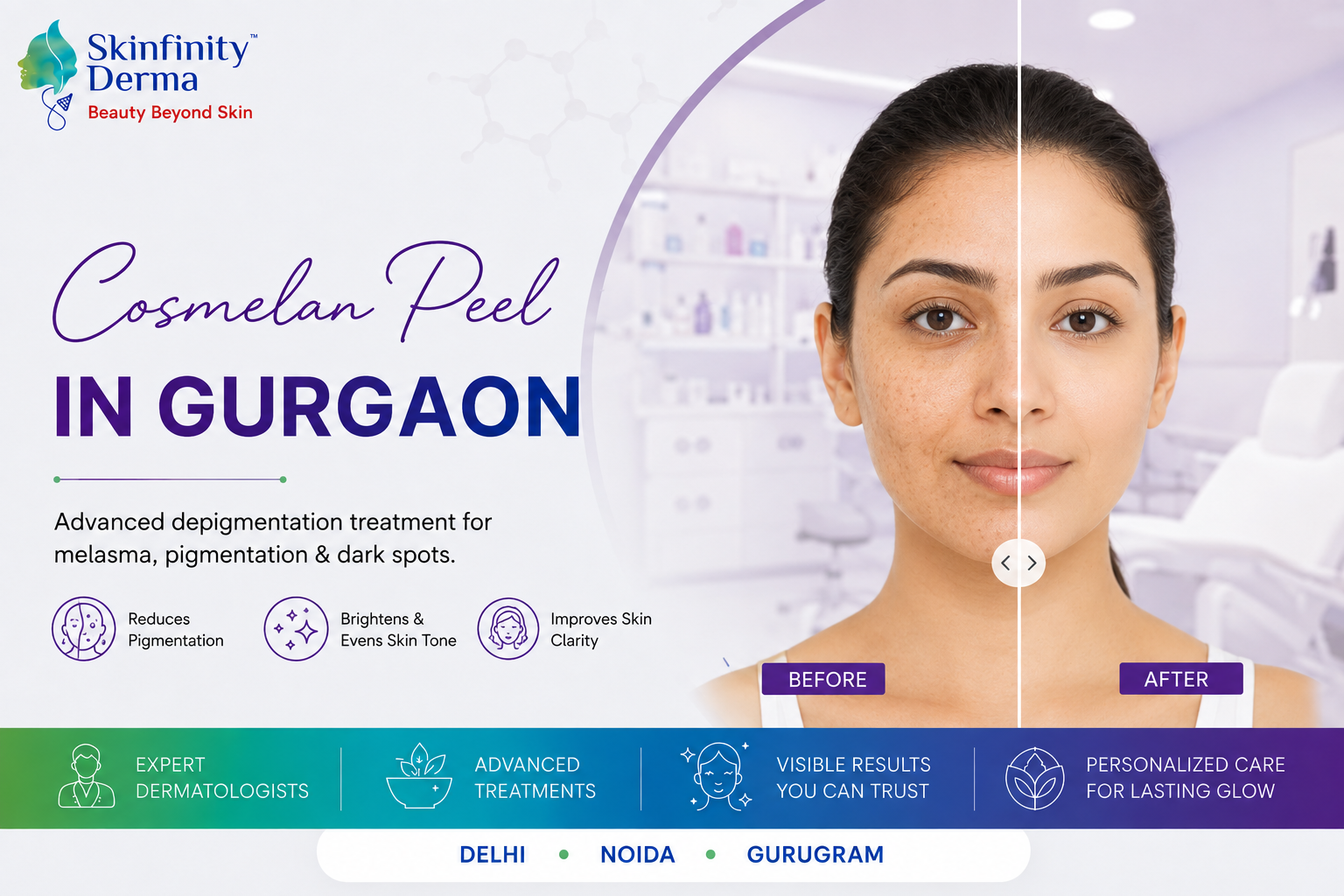 Cosmelan Peel in Gurgaon