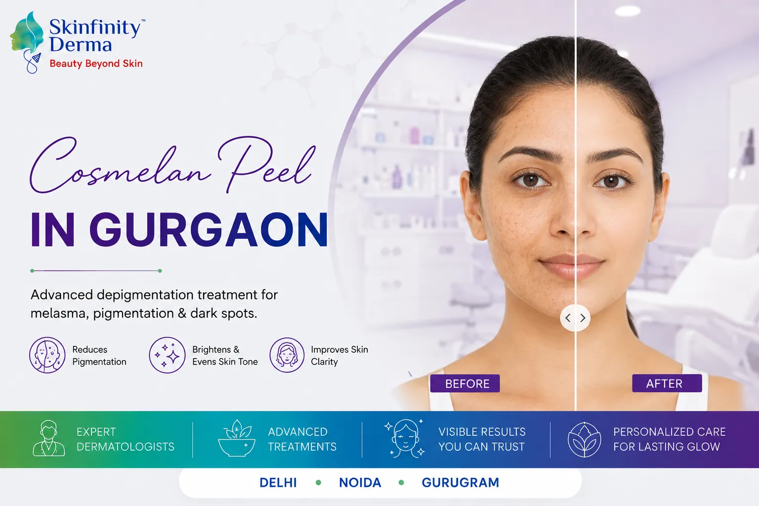 Cosmelan Peel in Gurgaon