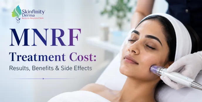 MNRF Treatment Cost in India