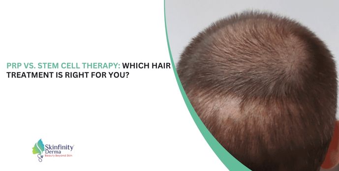 PRP vs stem cell therapy, hair loss treatments, PRP for hair regrowth, stem cell therapy for hair, PRP vs stem cell results, best hair restoration treatments, hair thinning solutions, regenerative hair therapies, PRP benefits, stem cell hair treatmen