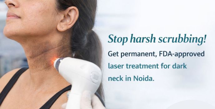 Dark Neck Treatment in Noida