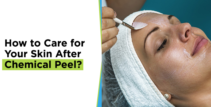 chemical peel treatment
