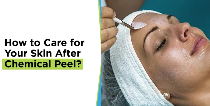 chemical peel treatment