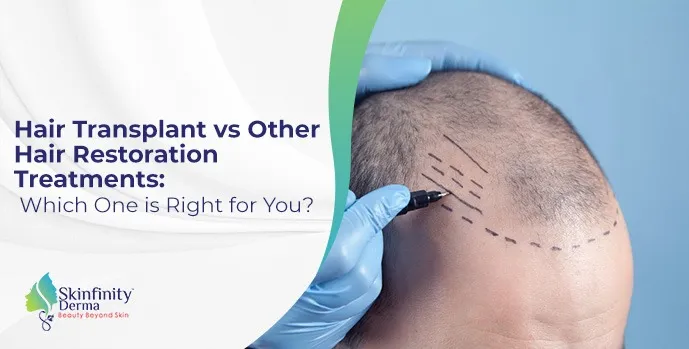 Hair Transplant vs Other Hair Restoration Treatments
