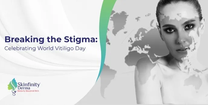 World Vitiligo Day, 
