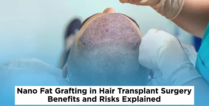 Nano Fat Grafting in Hair Transplant