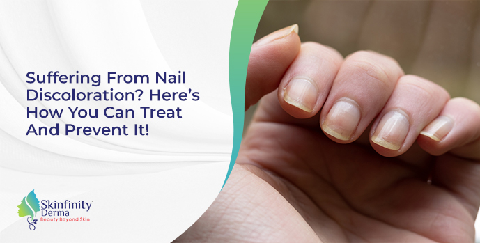 Suffering From Nail Discoloration? Read More | Skinfinity Derma Clinic