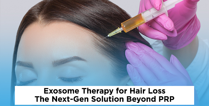 Exosome Therapy for Hair Loss