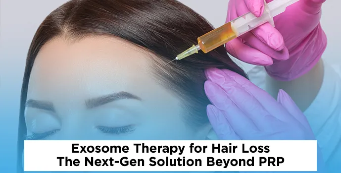 Exosome Therapy for Hair Loss