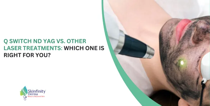 Q Switch Nd YAG vs. Other Laser