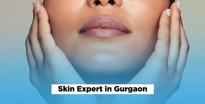 Skin Expert in Gurgaon 