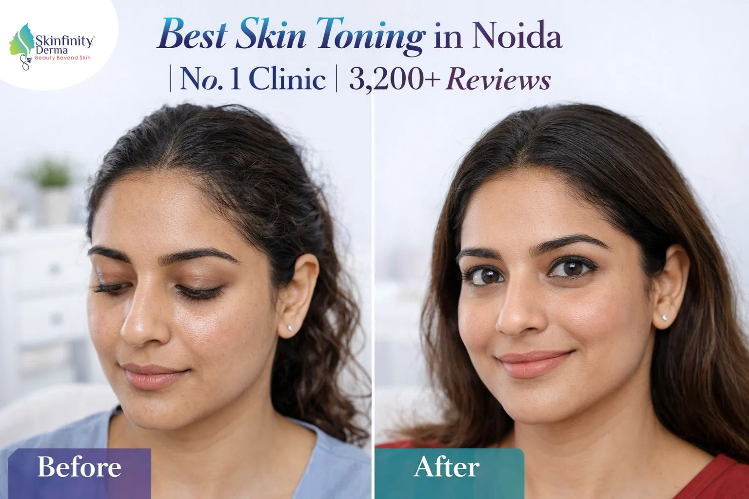 Best Skin Toning in Noida