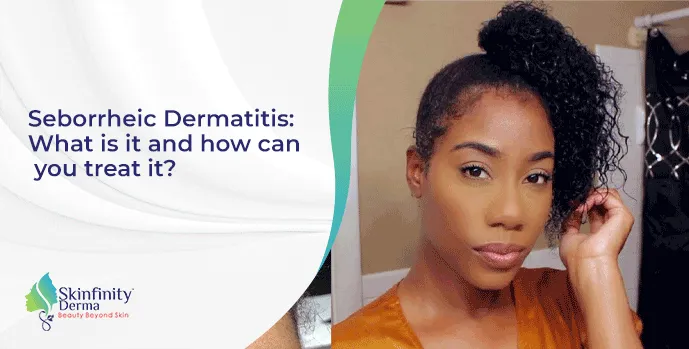 Seborrheic Dermatitis