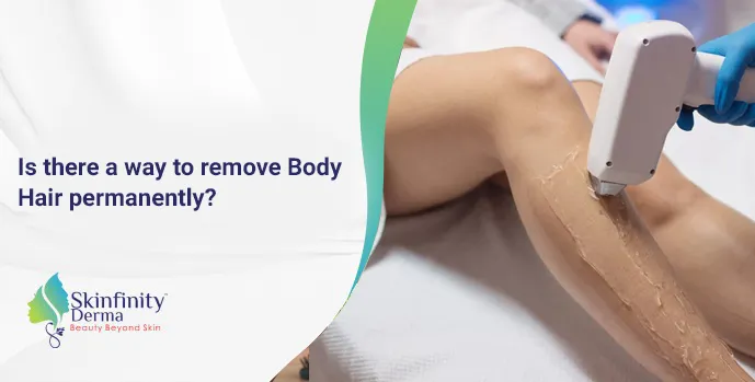 Permanent Hair Removal