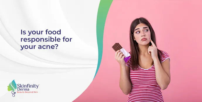 Is your food responsible for your acne