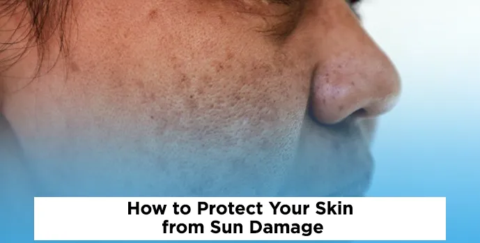 Protect Your Skin from Sun Damage
