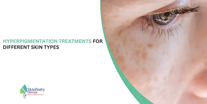 Hyperpigmentation treatment , 