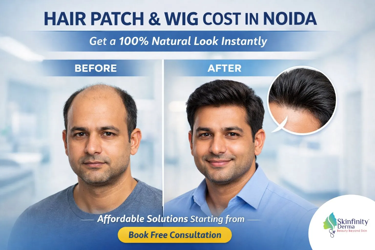 Hair Patch & Wig Cost in Noida