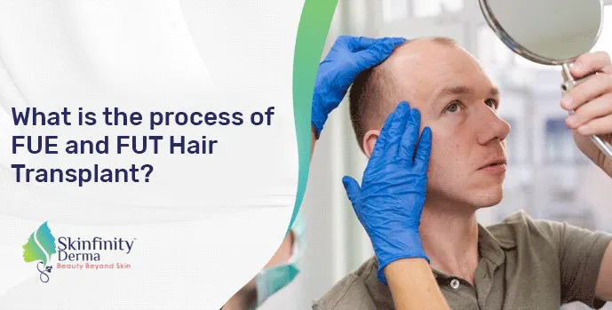 Hair Transplant
