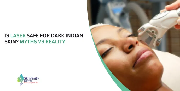 laser safe for dark skin