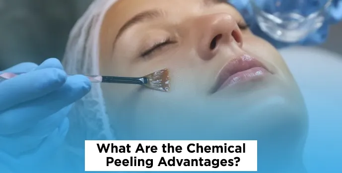 Chemical Peeling Advantages