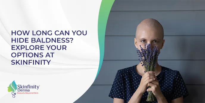 HOW LONG CAN YOU HIDE BALDNESS