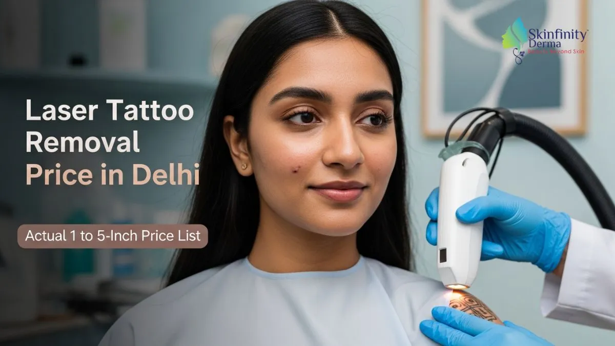 tattoo laser removal price