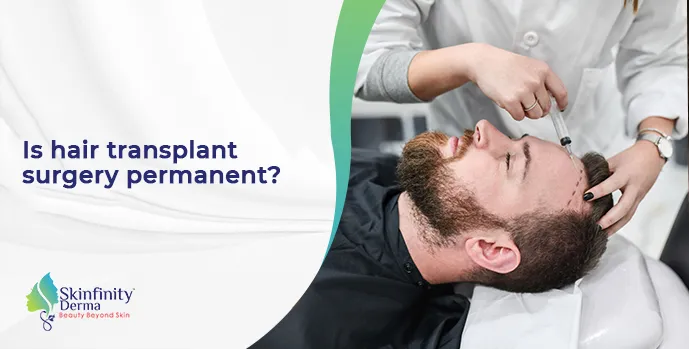 permanent hair transplant