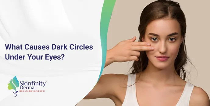 Dark Circle Treatment